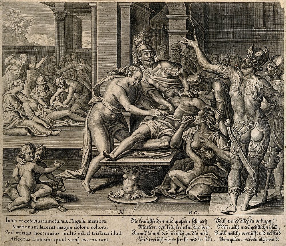Two surgical operations (one a caesarian delivery) take place in a crowded courtyard. Engraving by R. Custos.