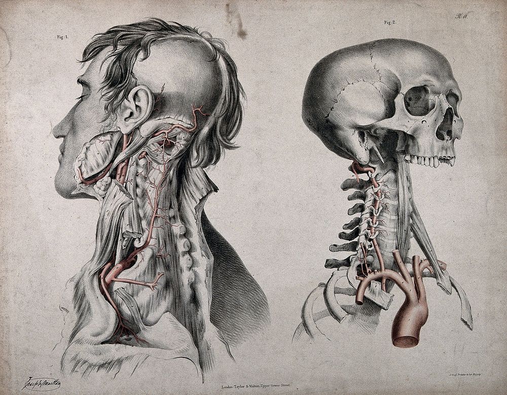 The circulatory system: two dissections of the neck, jaw and skull of a man, with aortic arch , arteries and blood vessels…