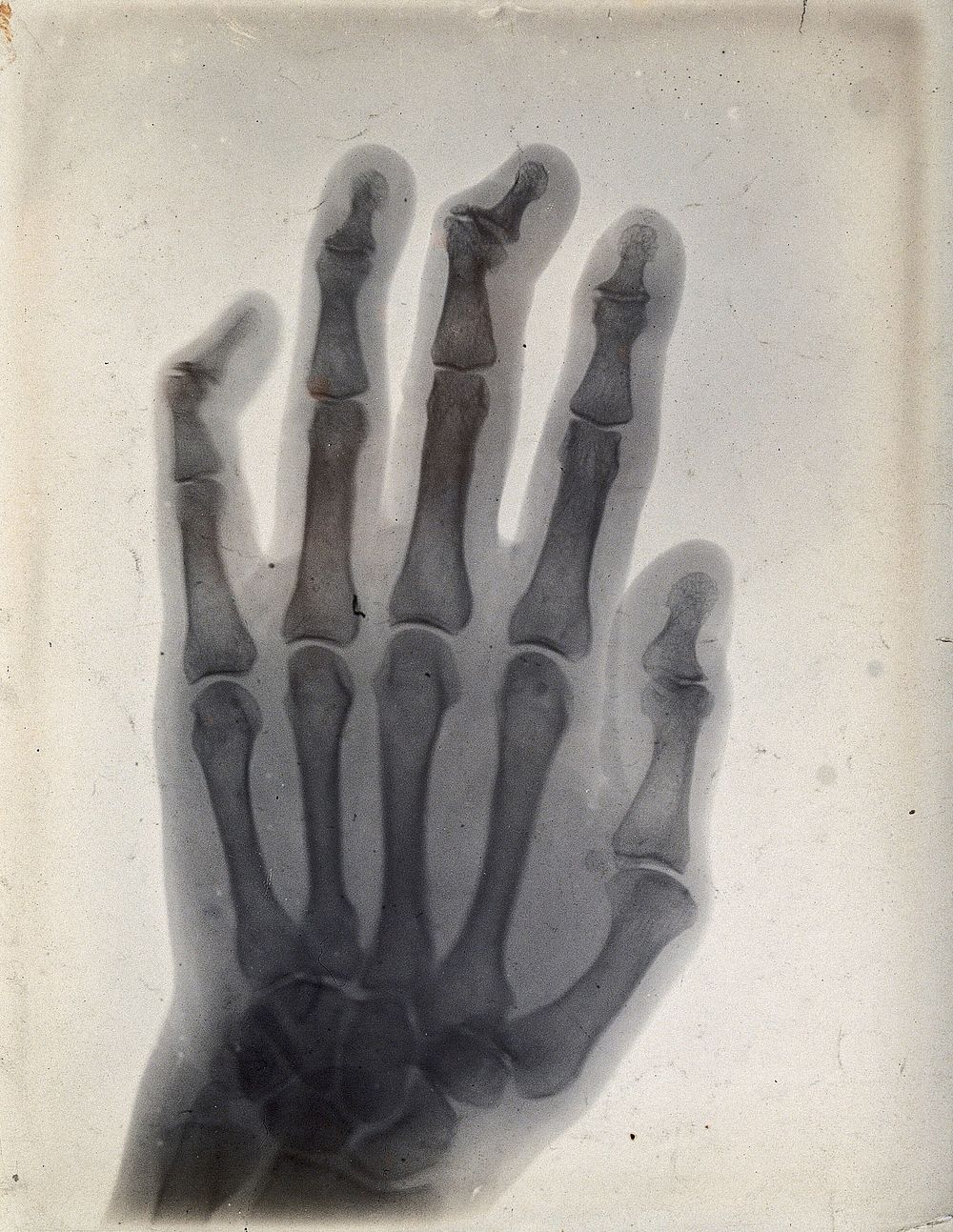 The bones of a hand, viewed through x-ray. Photoprint from radiograph after Sir Arthur Schuster, 1896.