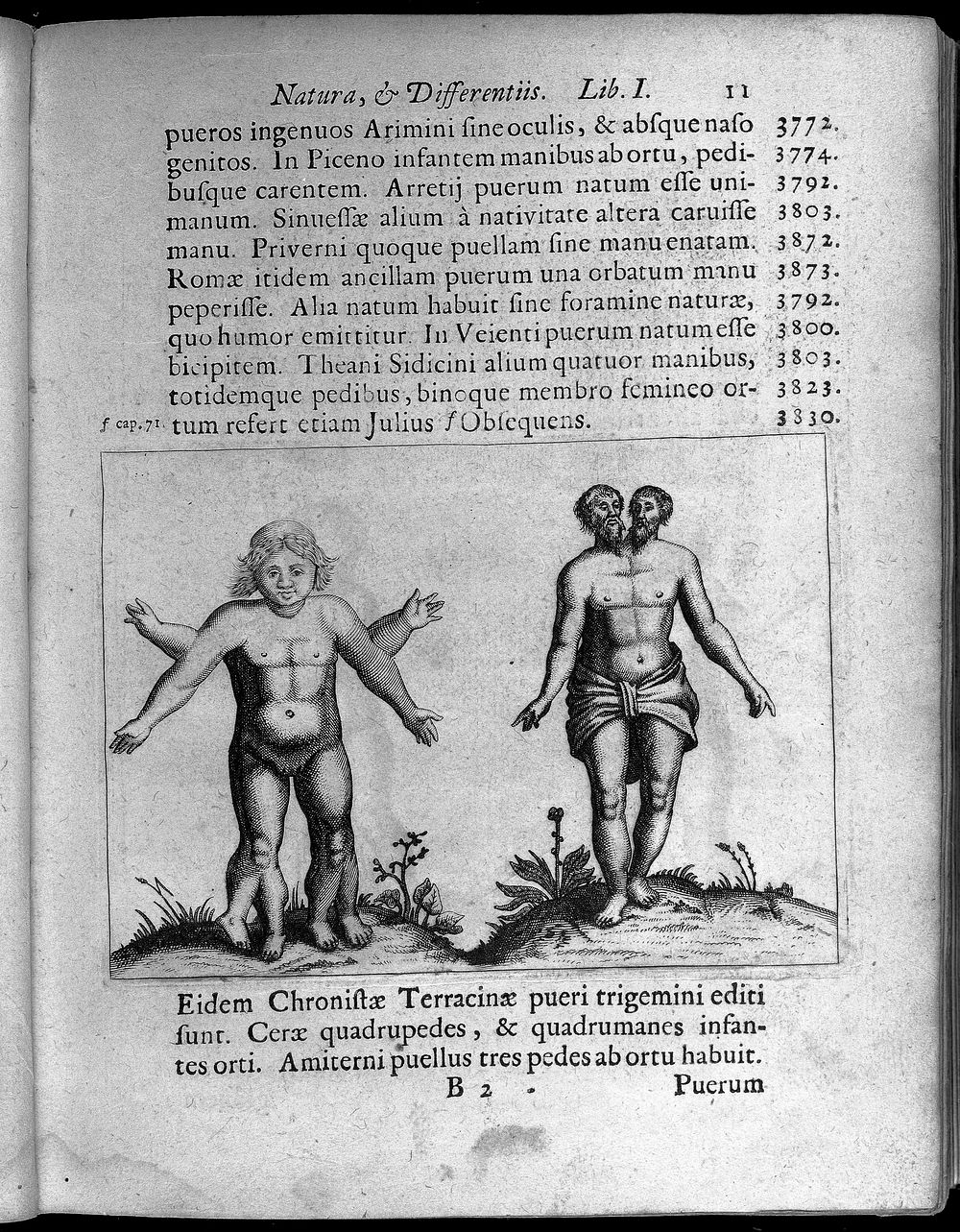 Two human figures with abnormalities, one with two sets of arms and legs and the other with two heads