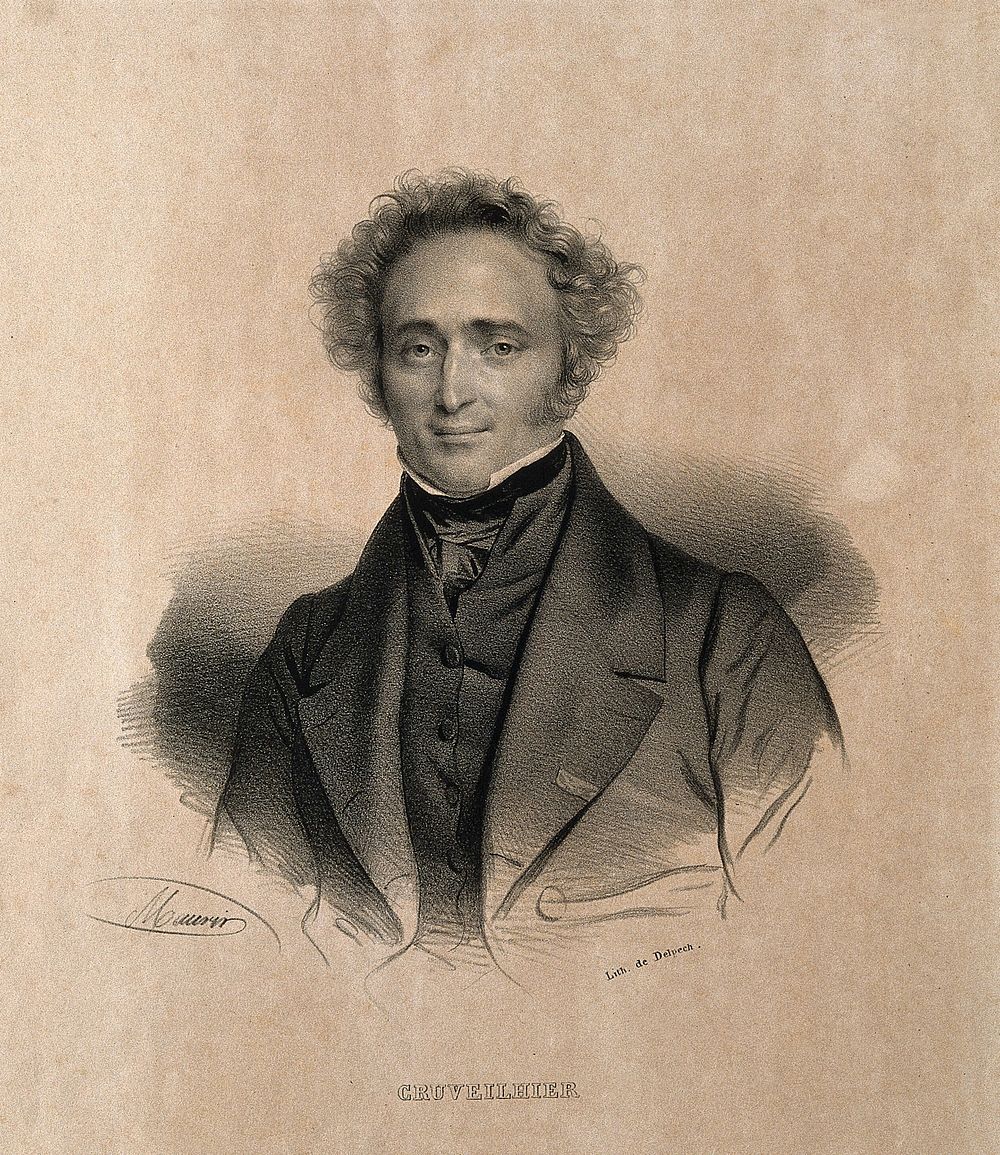 Jean Cruveilhier. Lithograph by N. E. Maurin.
