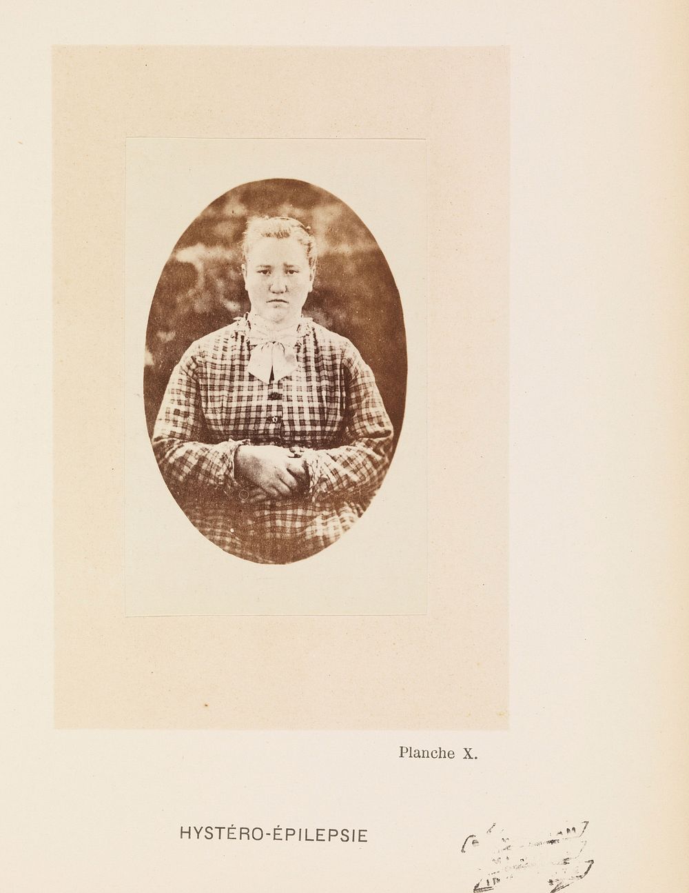Iconographie photographique de la Salpêtrière : service de M. Charcot / par Bourneville et P. Regnard.