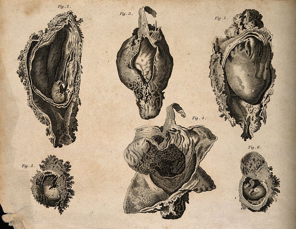 Foetus in utero: six figures. Stipple engraving by Campbell, after W. Hunter, 1816/1821.