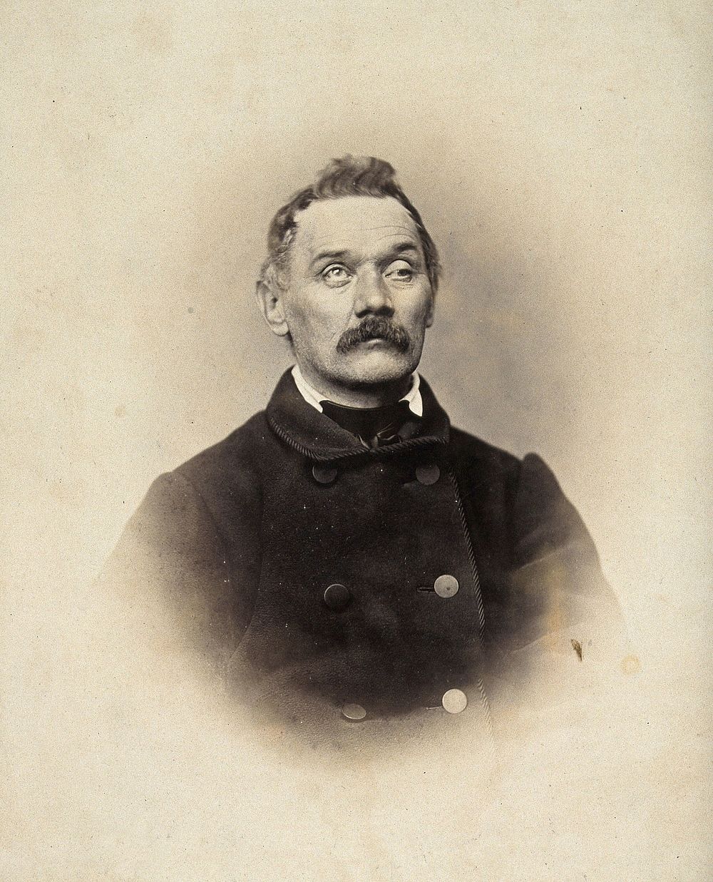 A man, head and shoulders; his left eyelid is heavy and his right eye is raised. Photograph by L. Haase after H.W. Berend…