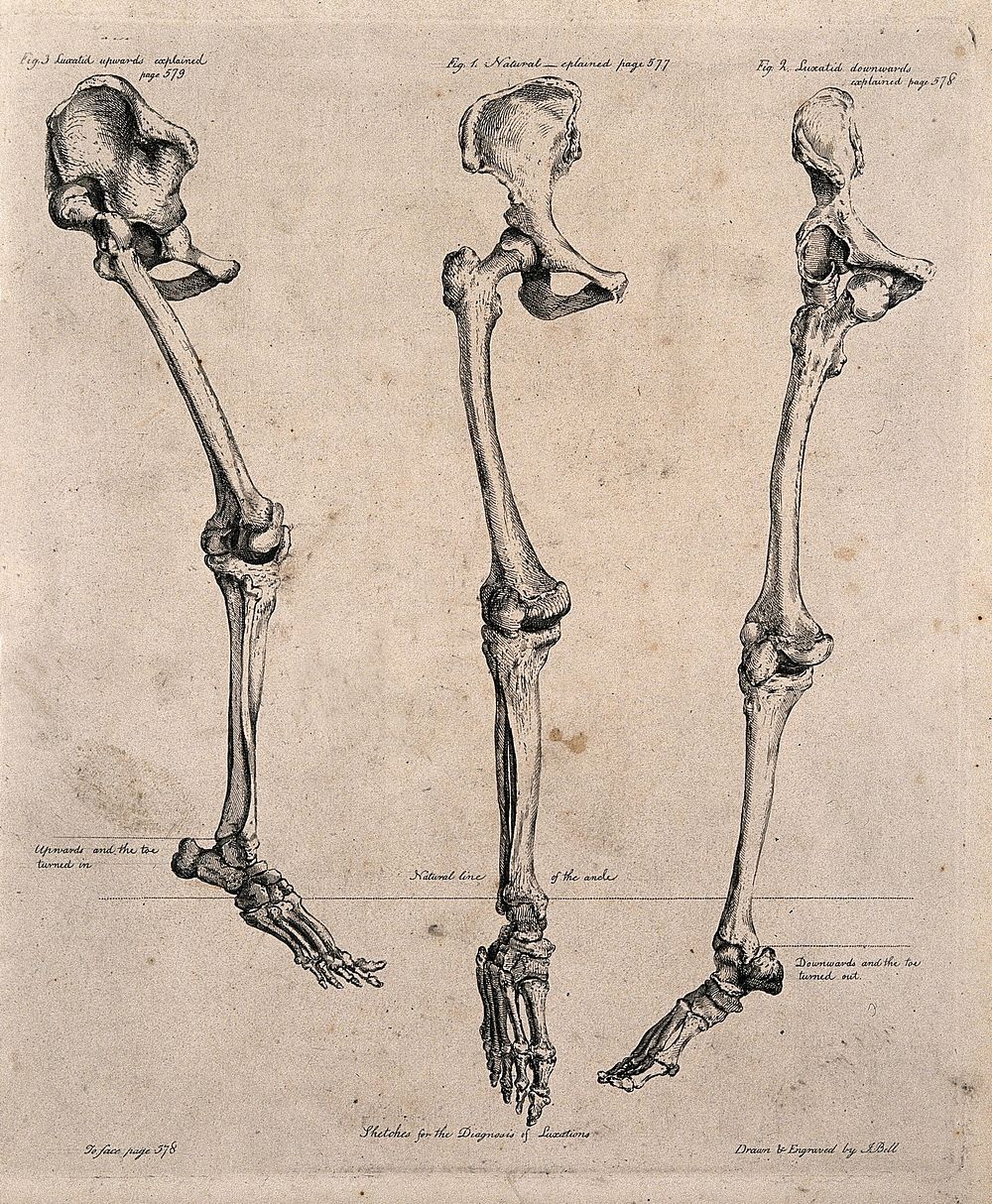 Three skeletal legs with pelvis and foot attached. Etching by J. Bell, c. 1810 .