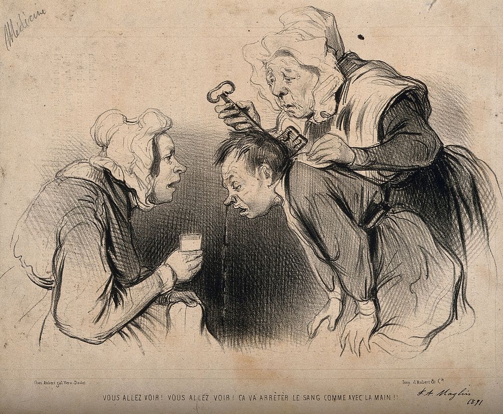 A maid puts a key down a man's shirt to stop his nosebleed. Lithograph, c. 1835-1841.