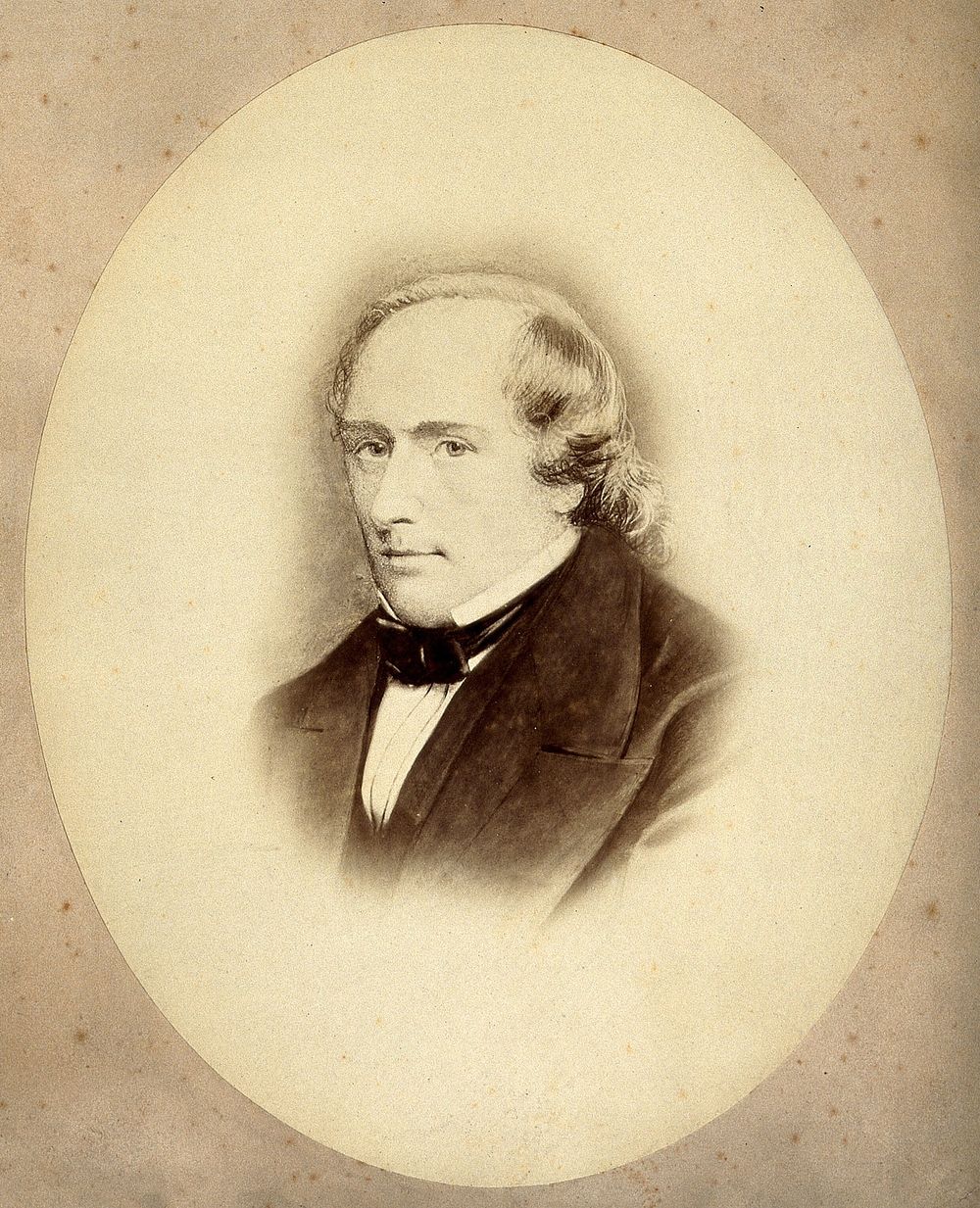 William Stokes. Photograph after a print.