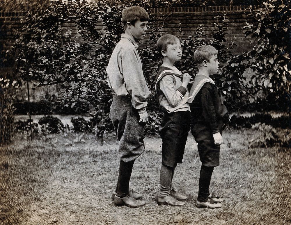 Three boys with Down's syndrome, standing in a line. Photograph, 1902.