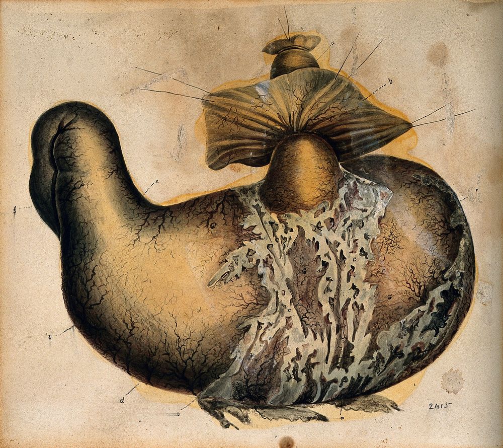 A stomach. Watercolour, 18--.