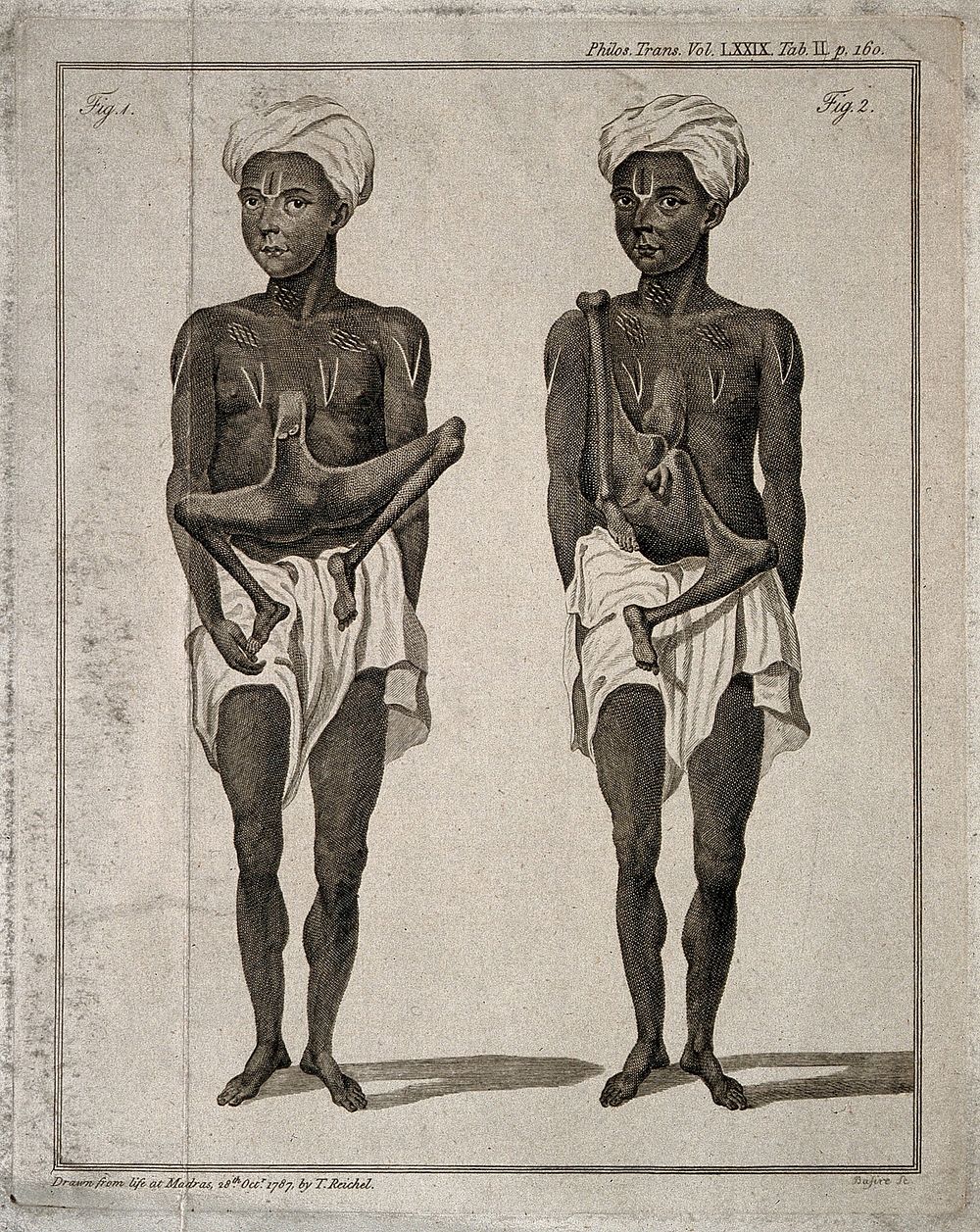 An Indian man with a headless body attached to his trunk. Engraving by J. Basire after T. Reichel, 1787.