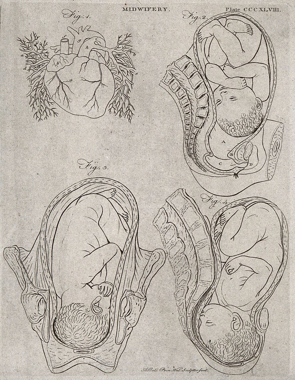 A diagram of the heart and three illustrations of babies in the womb. Engraving by A. Bell.