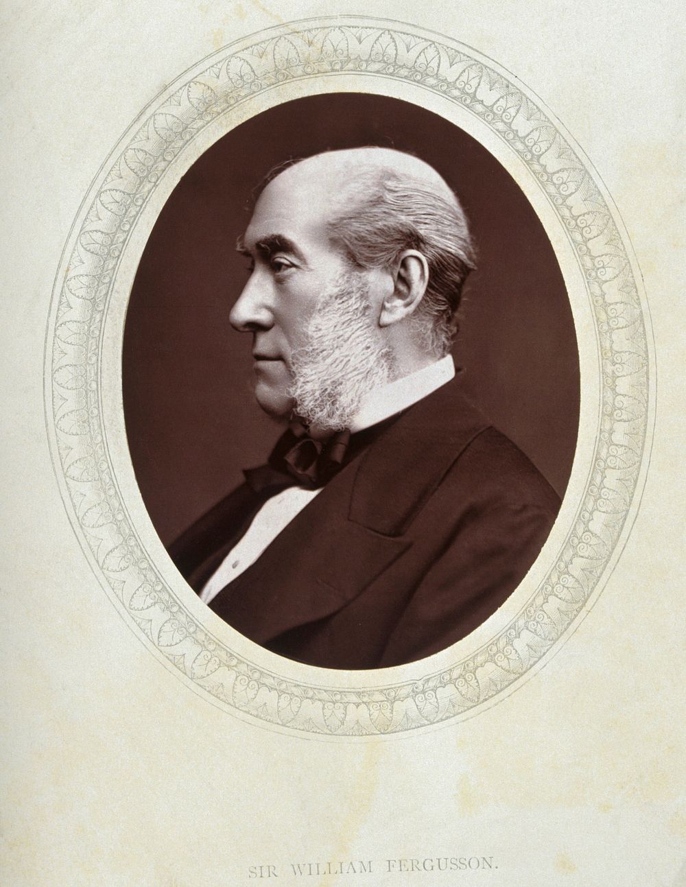 Sir William Fergusson. Photograph by Lock & Whitfield.