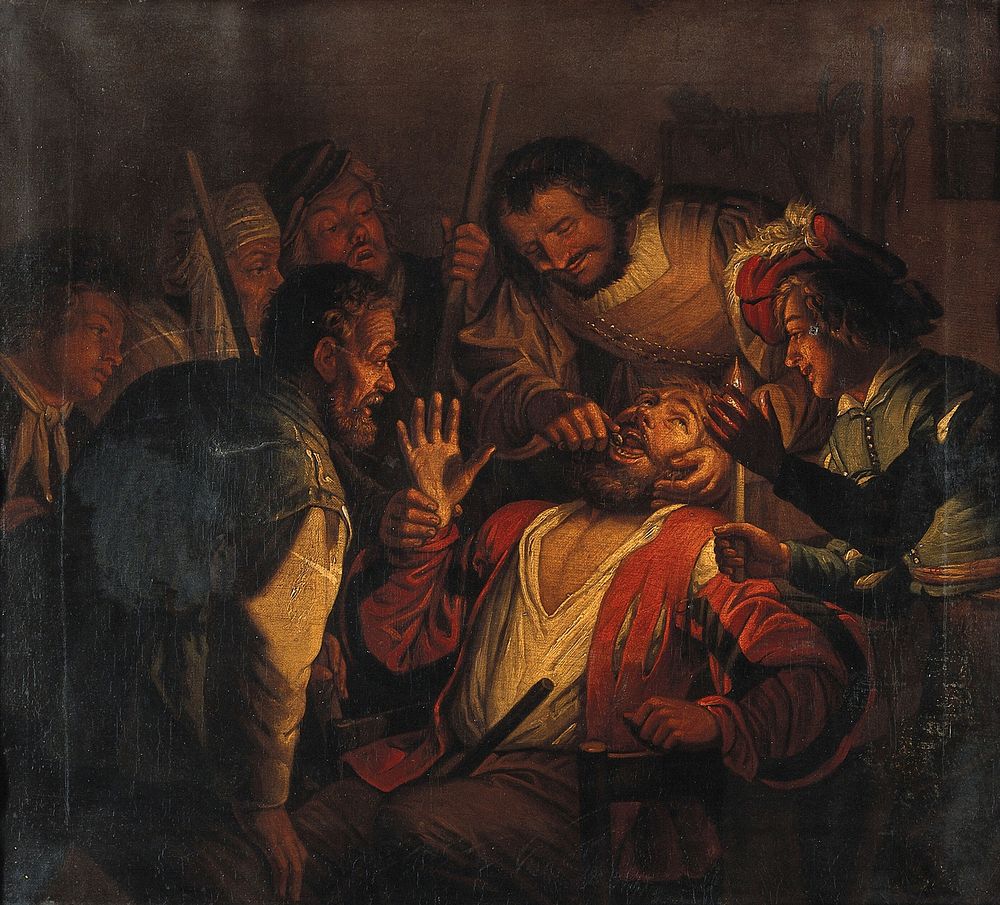 A surgeon extracting a tooth. Oil painting after Gerrit Honthorst.