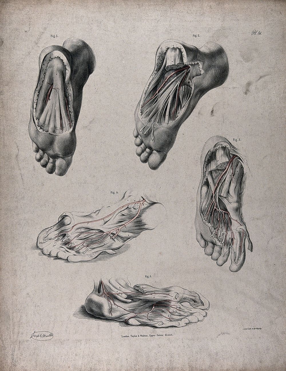 The circulatory system: dissections of the underside of the foot, with blood vessels indicated in red. Coloured lithograph…