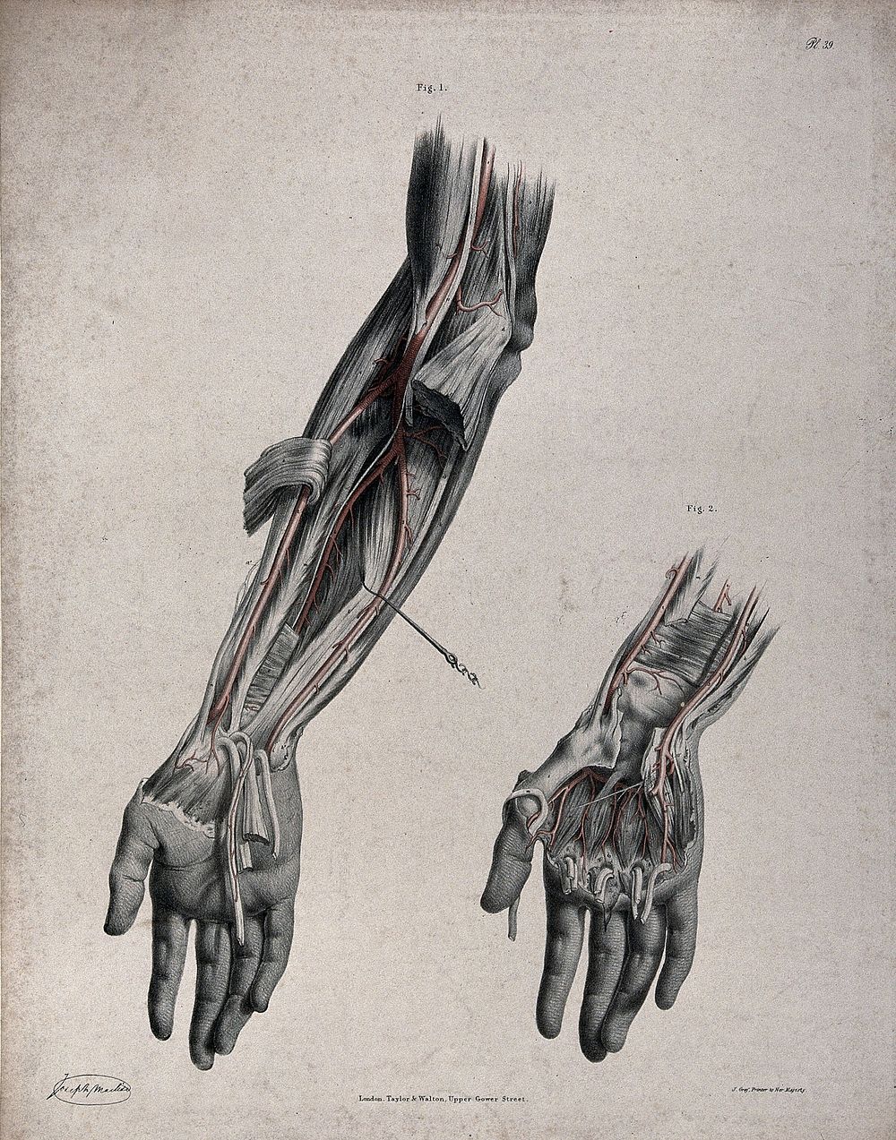 The circulatory system: two dissections of the arm and the hand, with arteries and blood vessels indicated in red. Coloured…