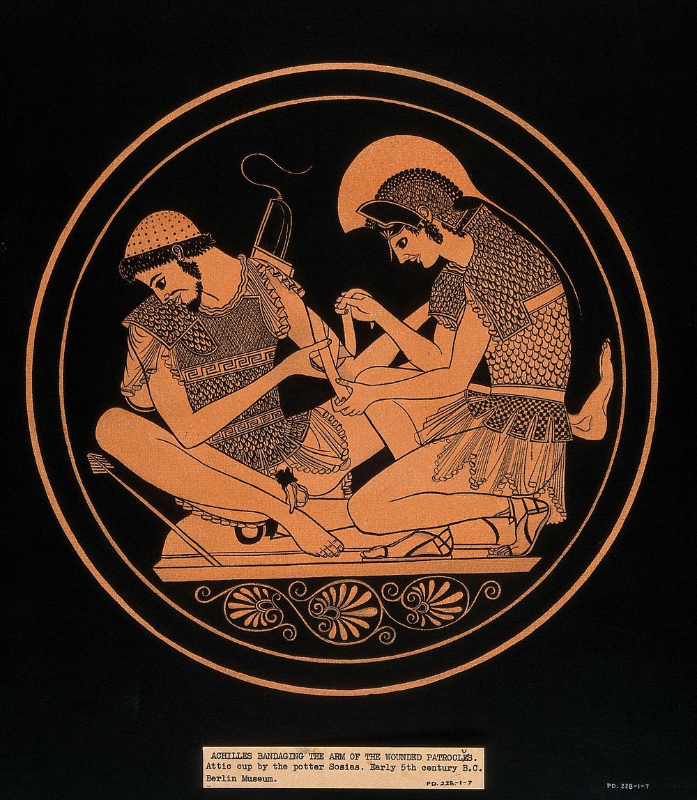 Achilles bandaging the wounded arm of Patroclus. Gouache painting by S.W. Kelly, 1936, after an Attic cup by Sosias, c. 500…
