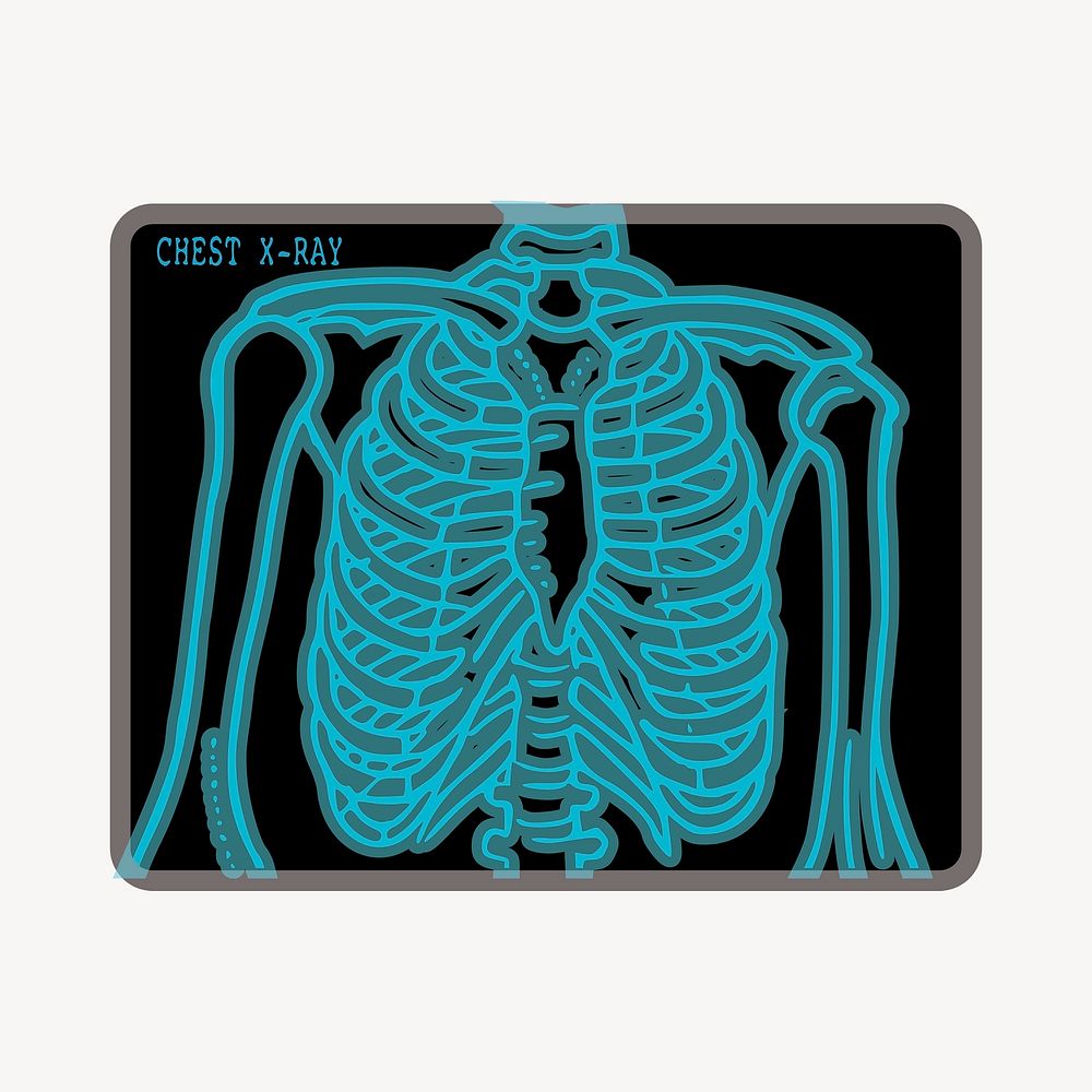 Chest X-ray clipart, medical illustration. Free public domain CC0 image.