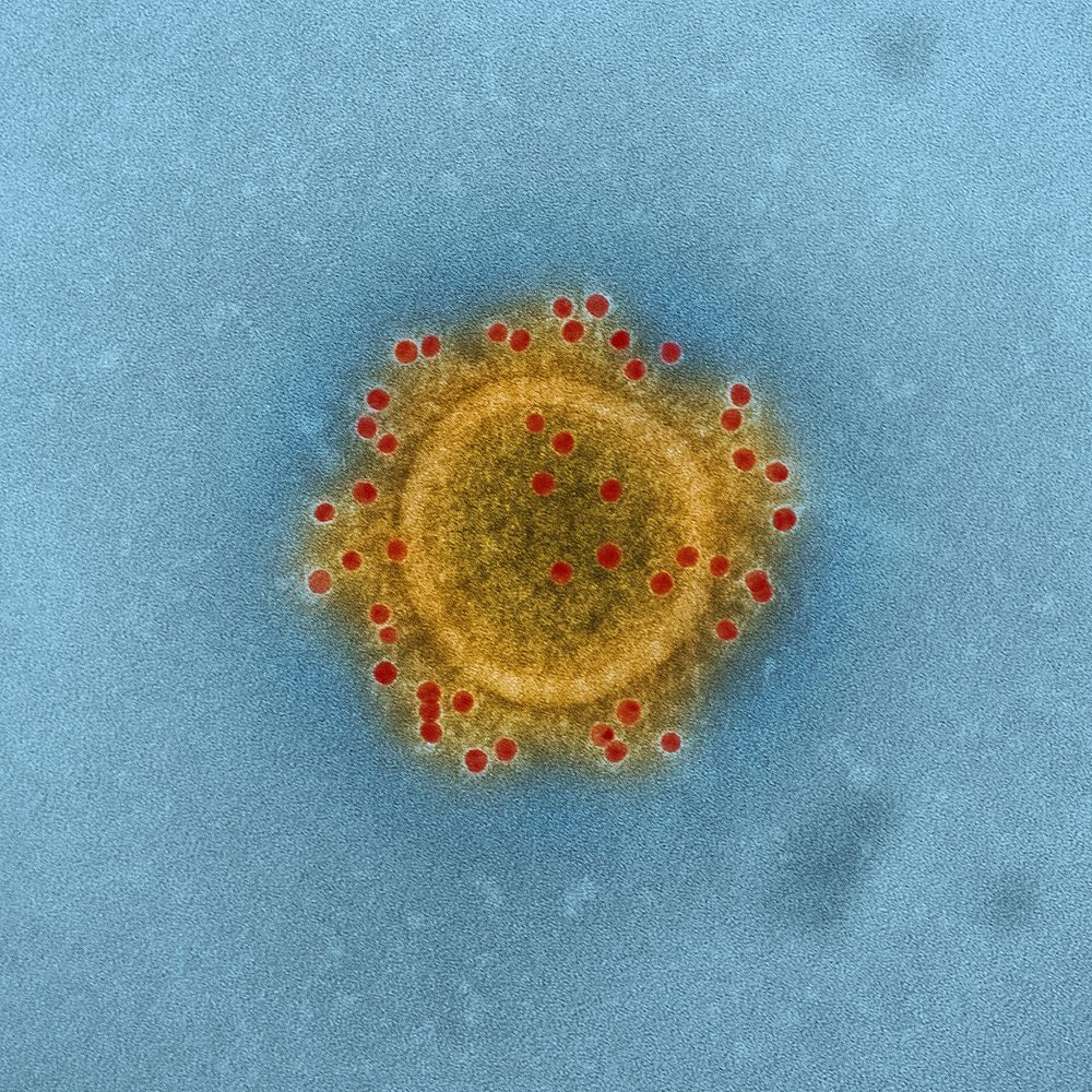 MERS Coronavirus Particle&ndash;Middle East Respiratory Syndrome Coronavirus particle envelope proteins immunolabeled with…