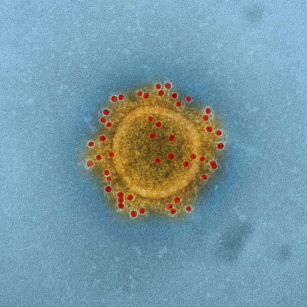 MERS Coronavirus Particle–Middle East Respiratory Syndrome Coronavirus particle envelope proteins immunolabeled with Rabbit…