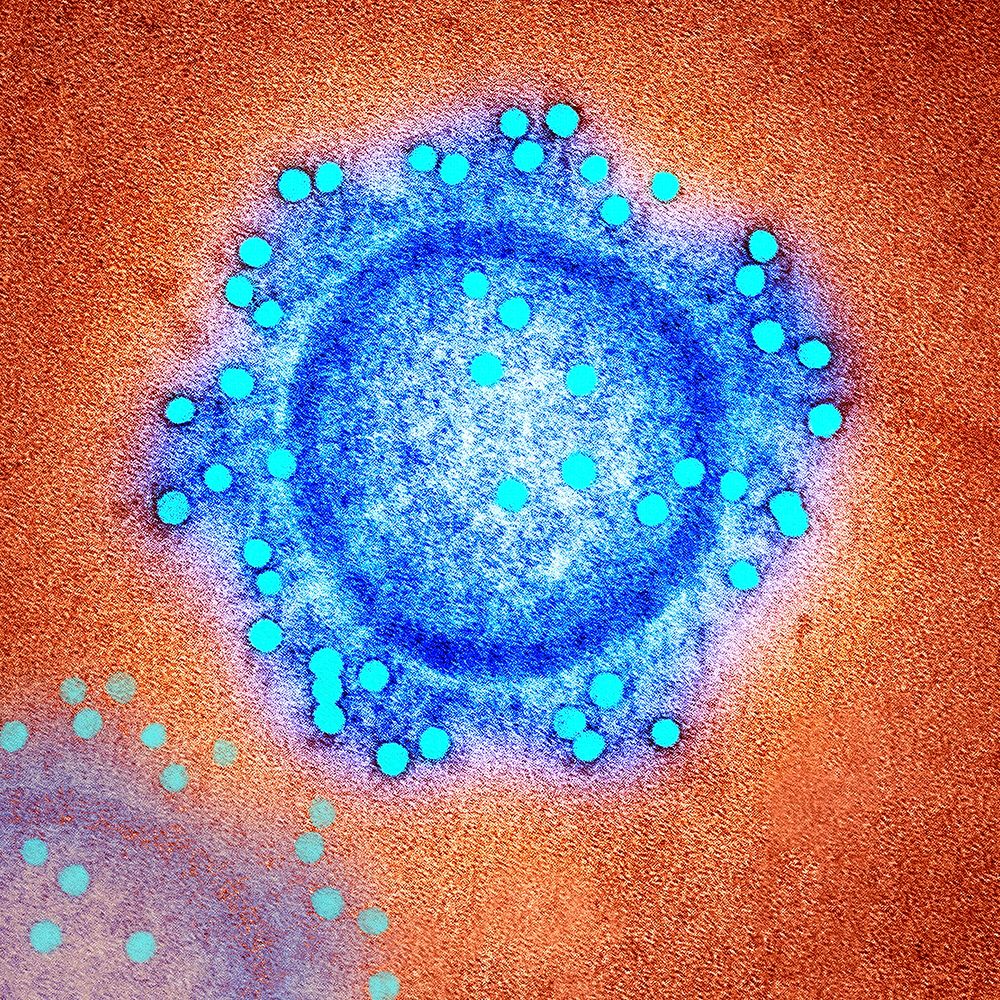 Coronavirus under the microscope