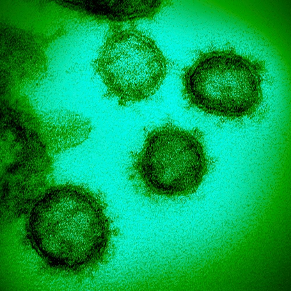 Novel Coronavirus 2019-nCoV electron microscope