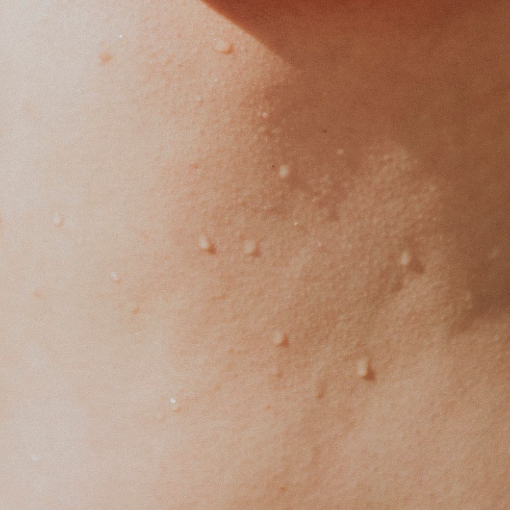 Sweaty woman's skin closeup