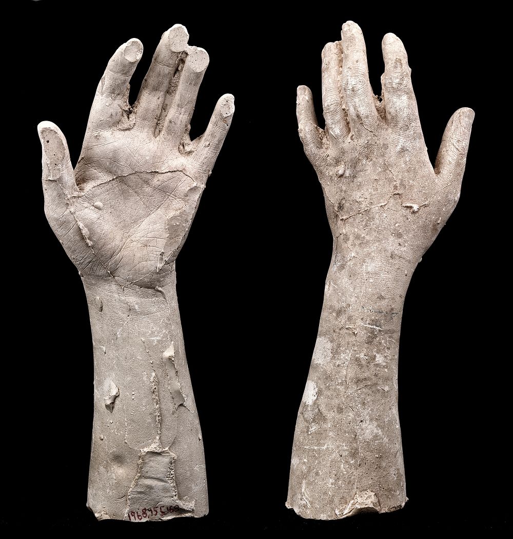 Cast of an Unidentified Woman's Left Hand and Forearm