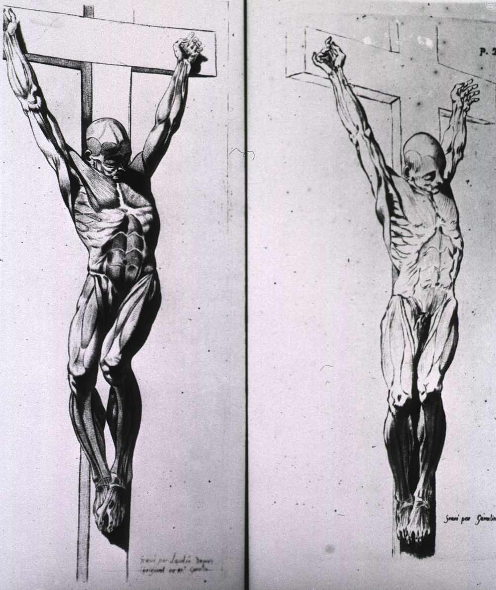 Musculature of the human bodyCollection: Images from the History of Medicine (IHM) Author(s): Gamelin, Jacques, 1739-1803…