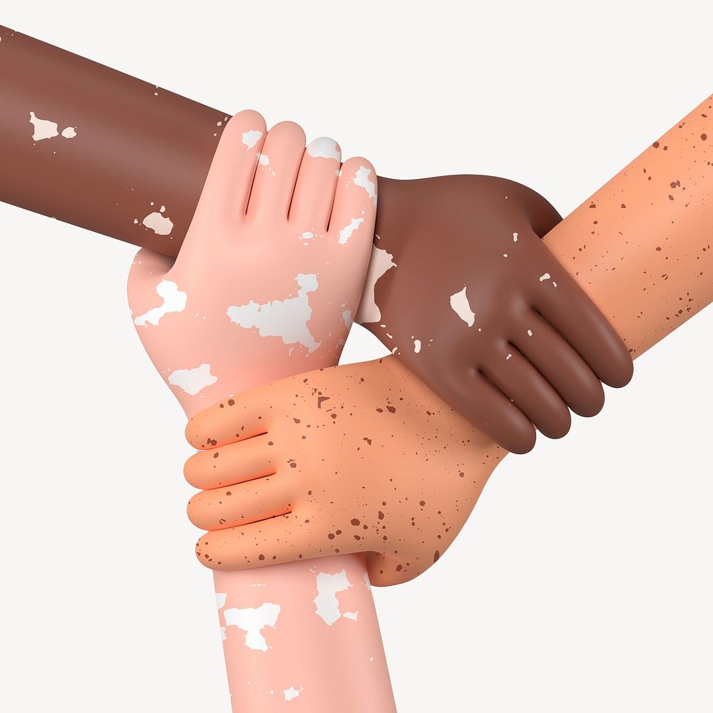 Diverse vitiligo hands united, 3D rendering graphic