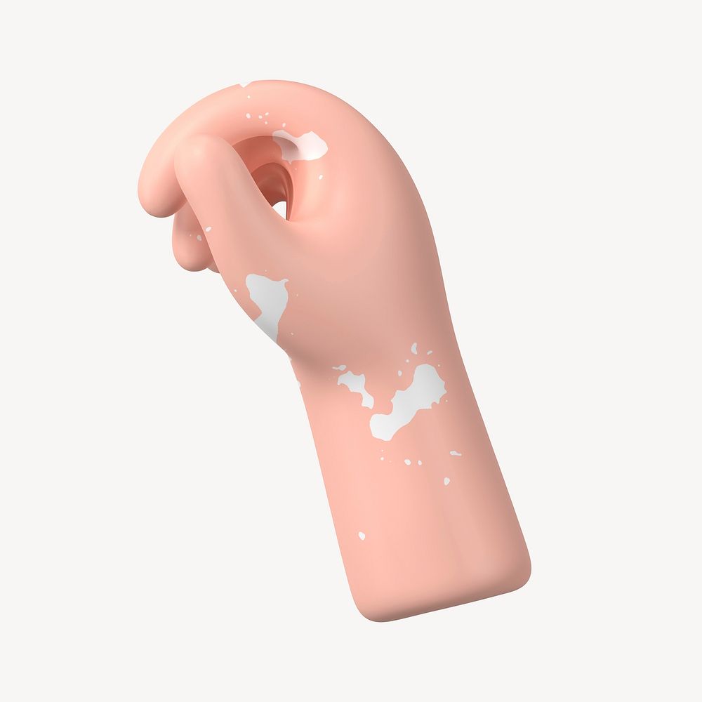 Vitiligo hand gesture, 3D body part illustration
