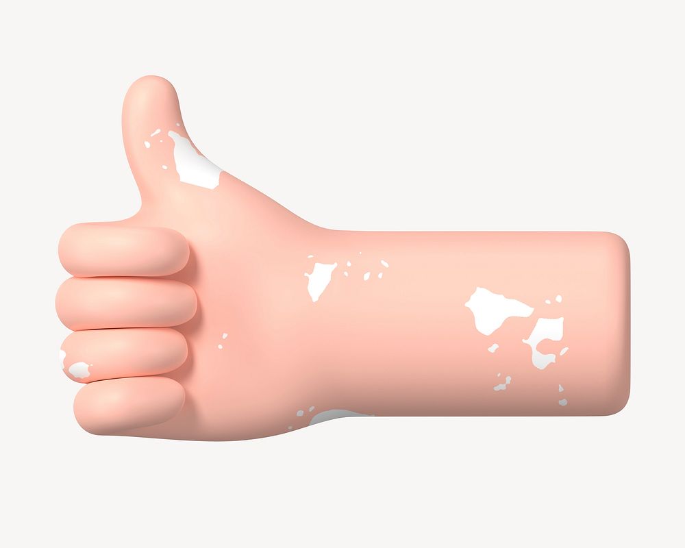 Thumbs up hand gesture, vitiligo awareness, 3D illustration