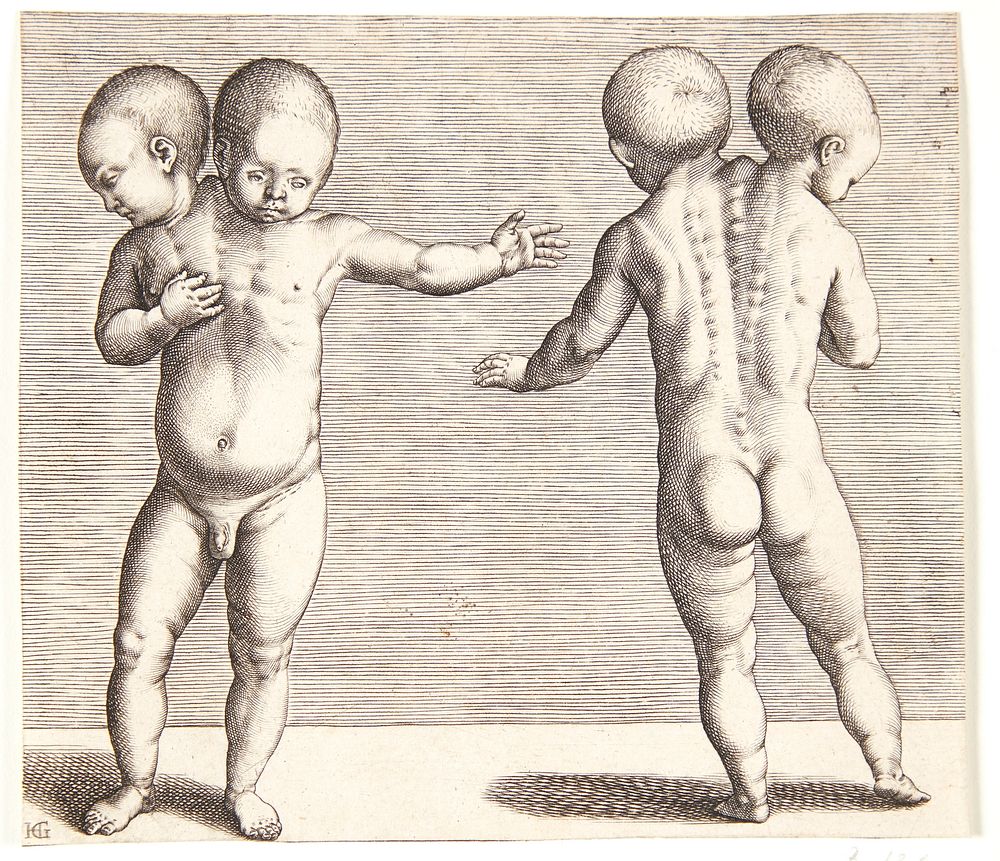 A deformed child with two heads by Hendrick Goltzius