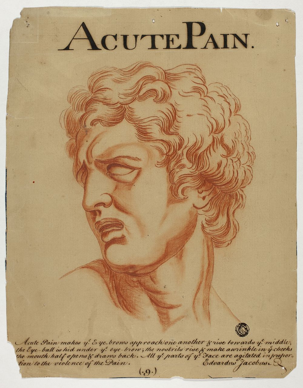 Acute Pain by Eduardus Jacobus
