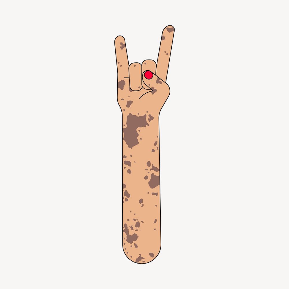 Vitiligo rock n' roll hand sign, flat illustration