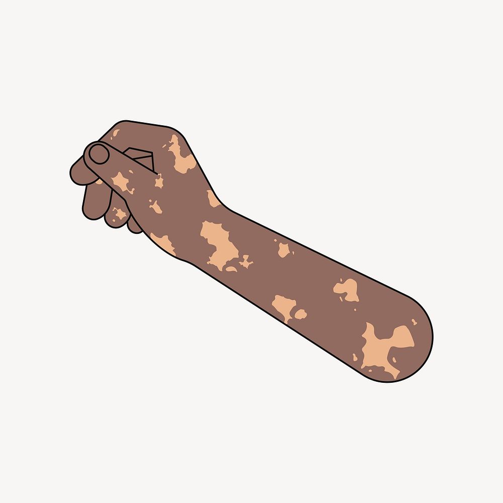 Black vitiligo hand arm, gesture flat collage element vector