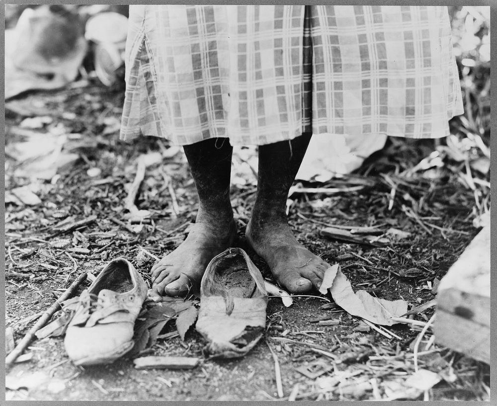Feet of  cotton hoer near Clarksdale, Mississippi by Dorothea Lange