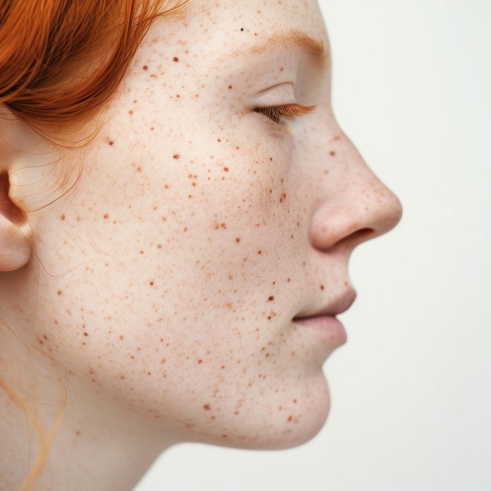 Freckle adult woman skin. 