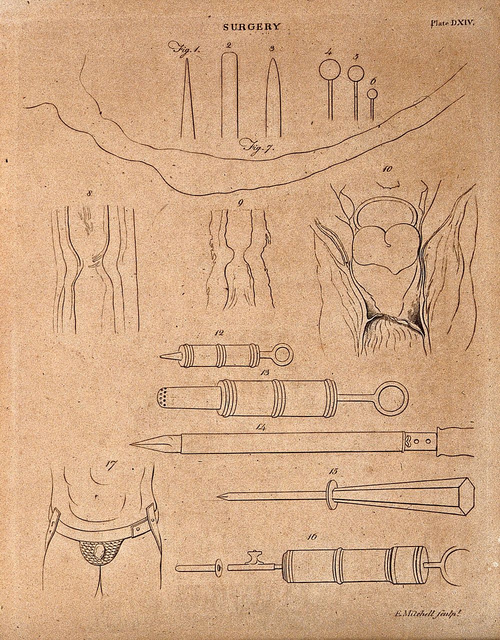 Surgical instruments, spatulas and syringes. Engraving by E. Mitchell.
