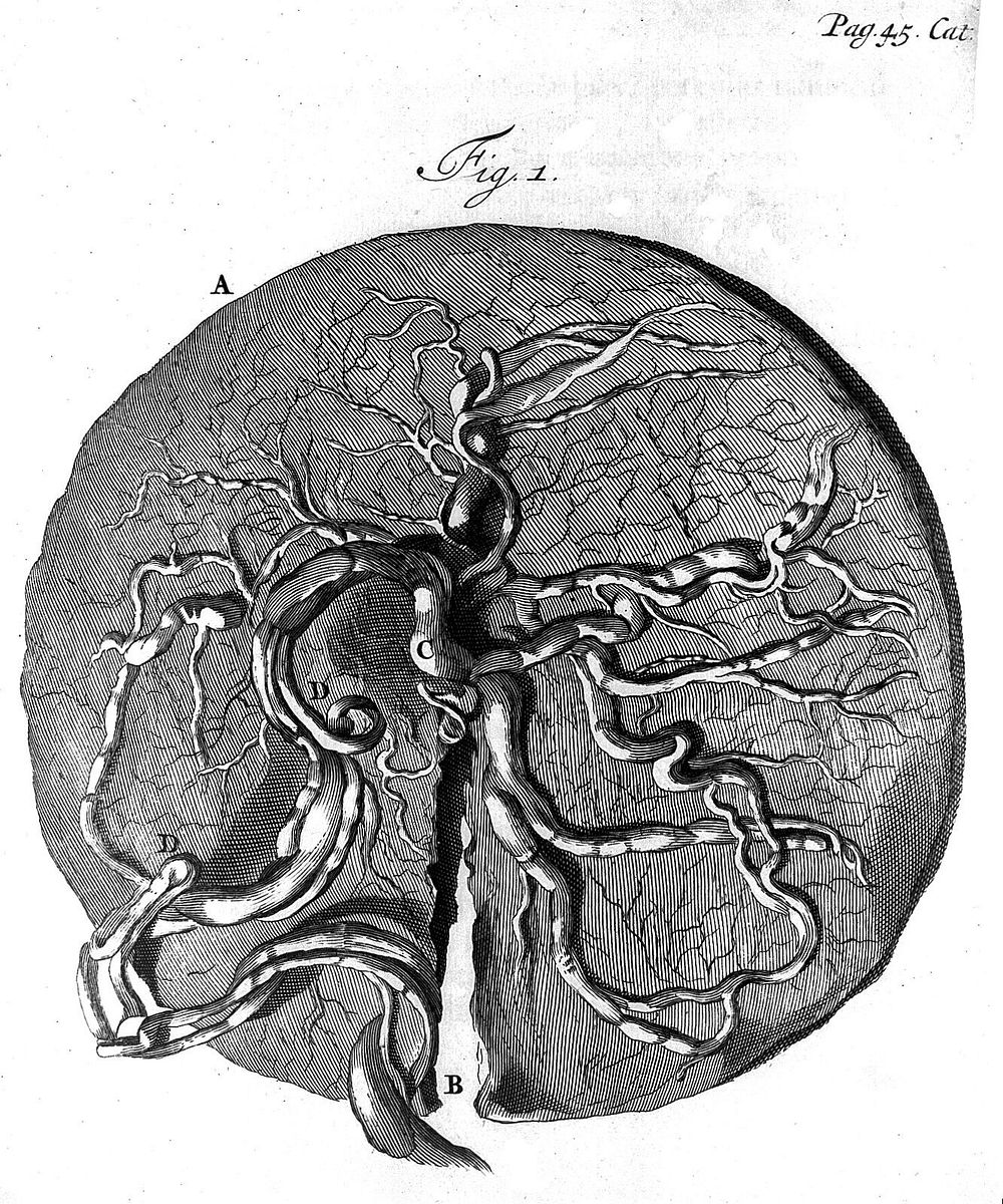 Frederici Ruyschii ... Observationum anatomico-chirurgicarum centuria : accedit Catalogus rariorum, quae in Museo Ruyschiano…