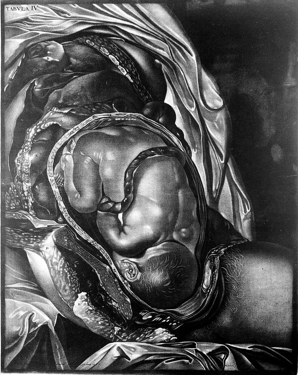 Demonstratio uteri praegnantis mulieris cum foetu ad partum maturi tabulis ... ea methodo dispositis, ut hujus status…