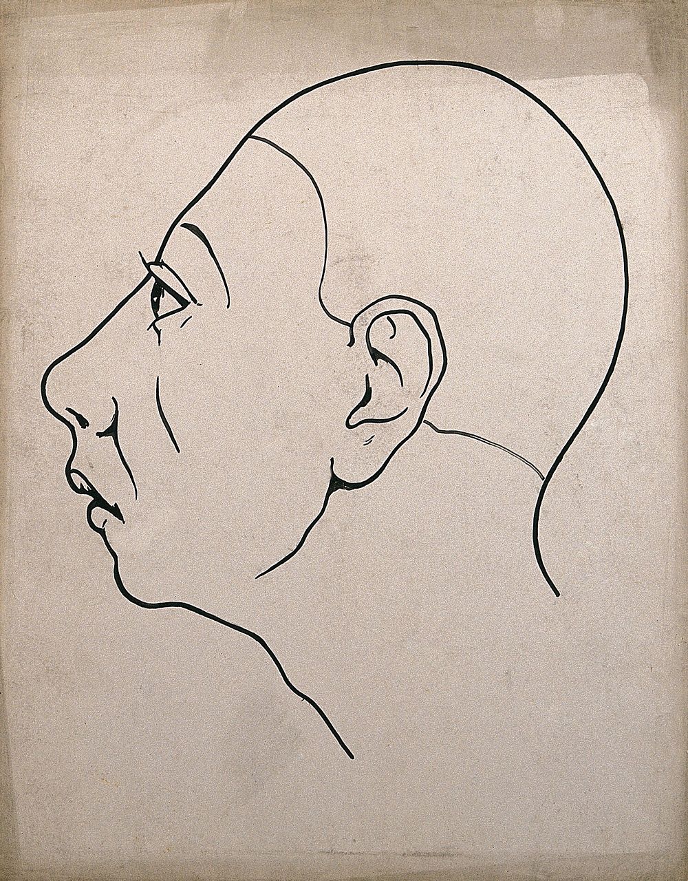 Left profile of a head showing depressed frontal lobes. Drawing, c. 1900.