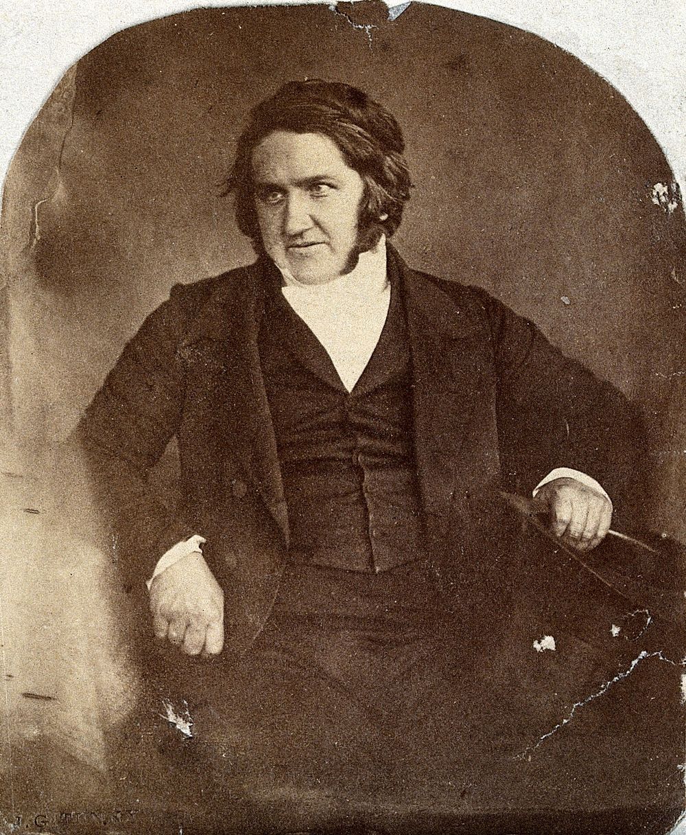 Sir James Young Simpson. Photograph by J.G. Tunny.