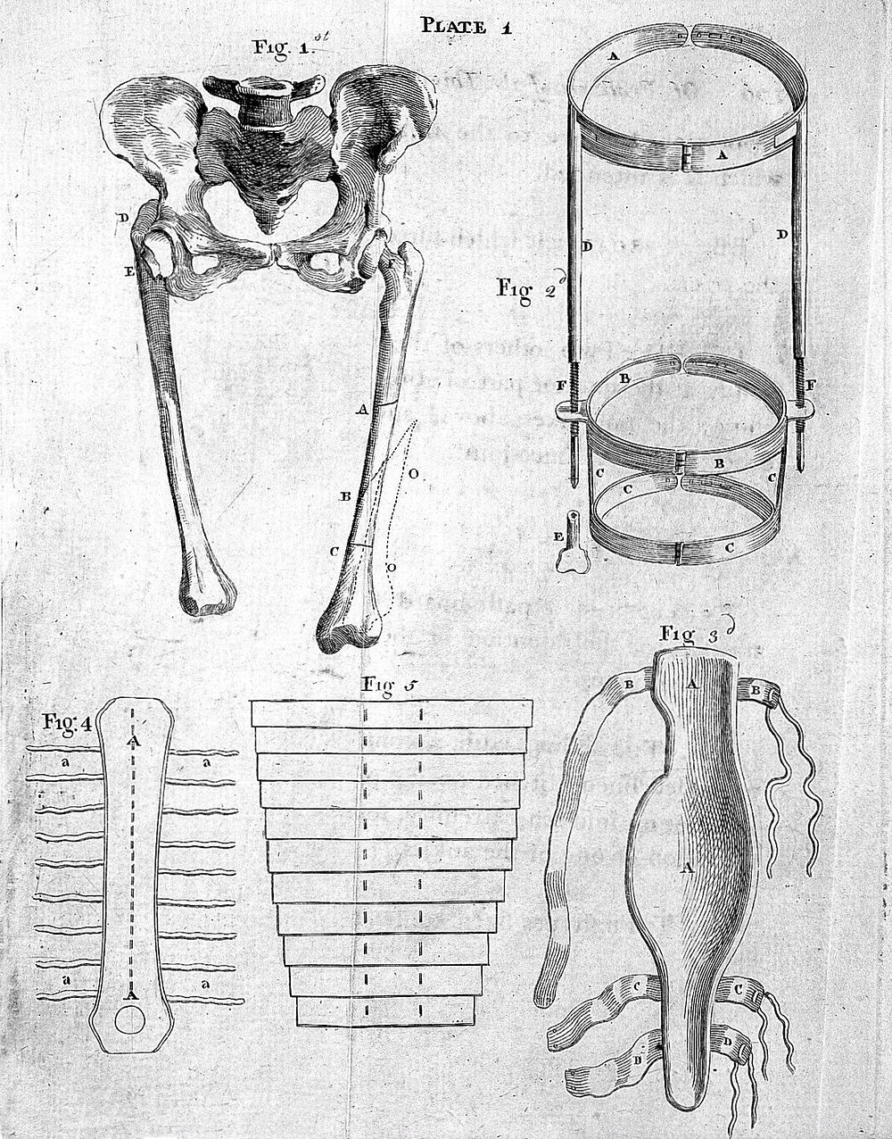 Essays on several important subjects in surgery: chiefly on the nature and cure of fractures of the long bones of the…