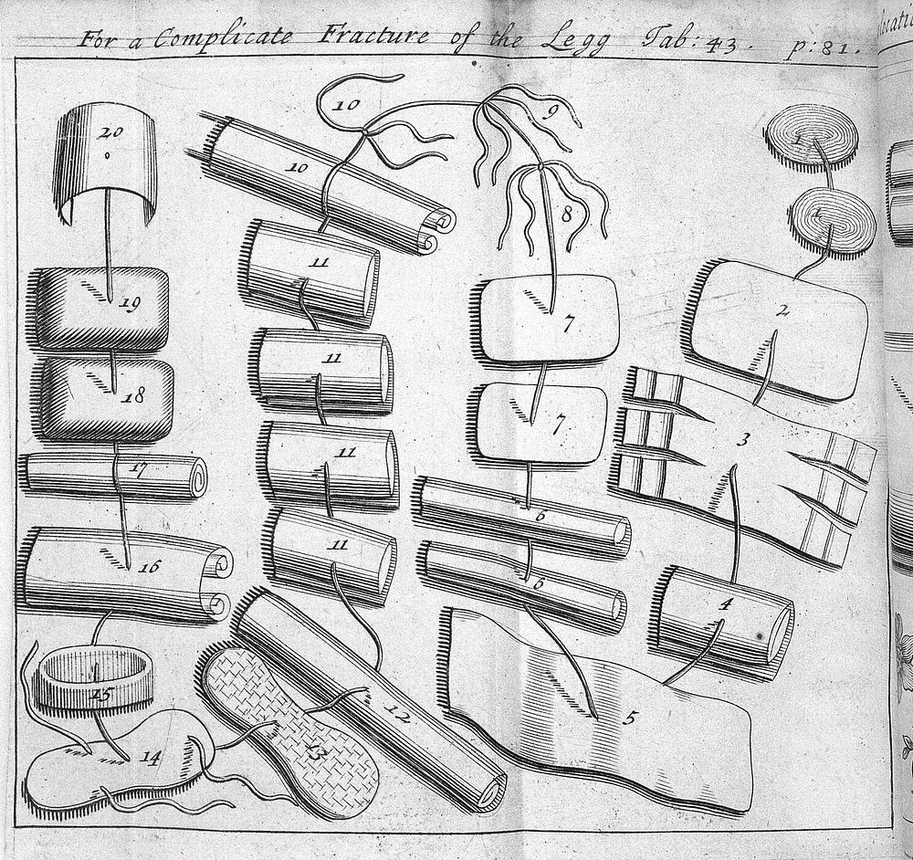 A description of bandages and dressings, according to the most commodious ways now used in France / Written in French ...…