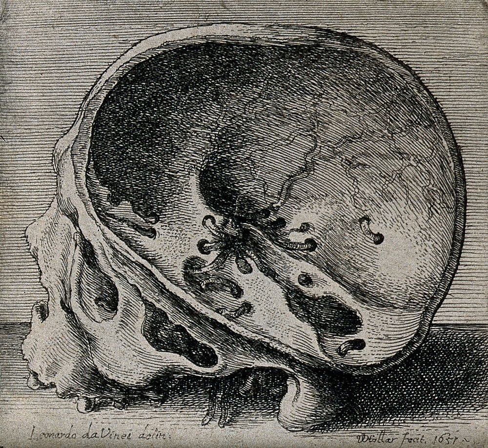 Cross-section of skull in profile view, showing the intercranial nerves and vessels. Etching by Wenceslaus Hollar after…