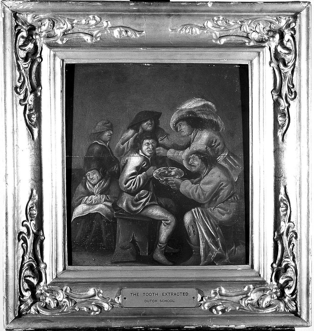 An operator extracting "pierres de tête" from behind a man's ear, with four other people in attendance. Oil painting by a…