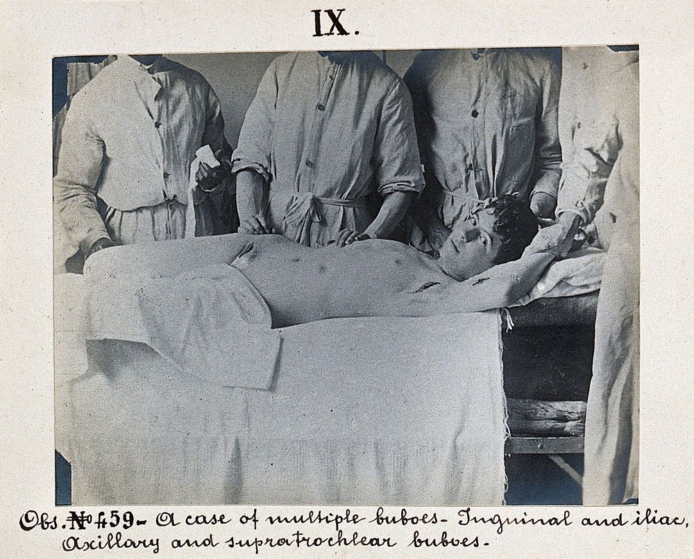 Seamen's Hospital for infectious diseases in Jurujuba, Rio de Janeiro; a young male plague patient lying on a bed, being…