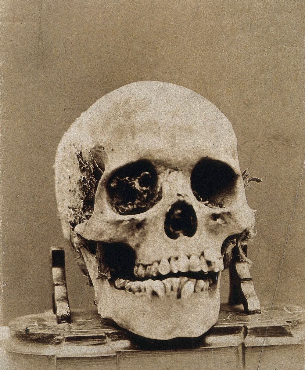 A skull from Peru. Photograph.