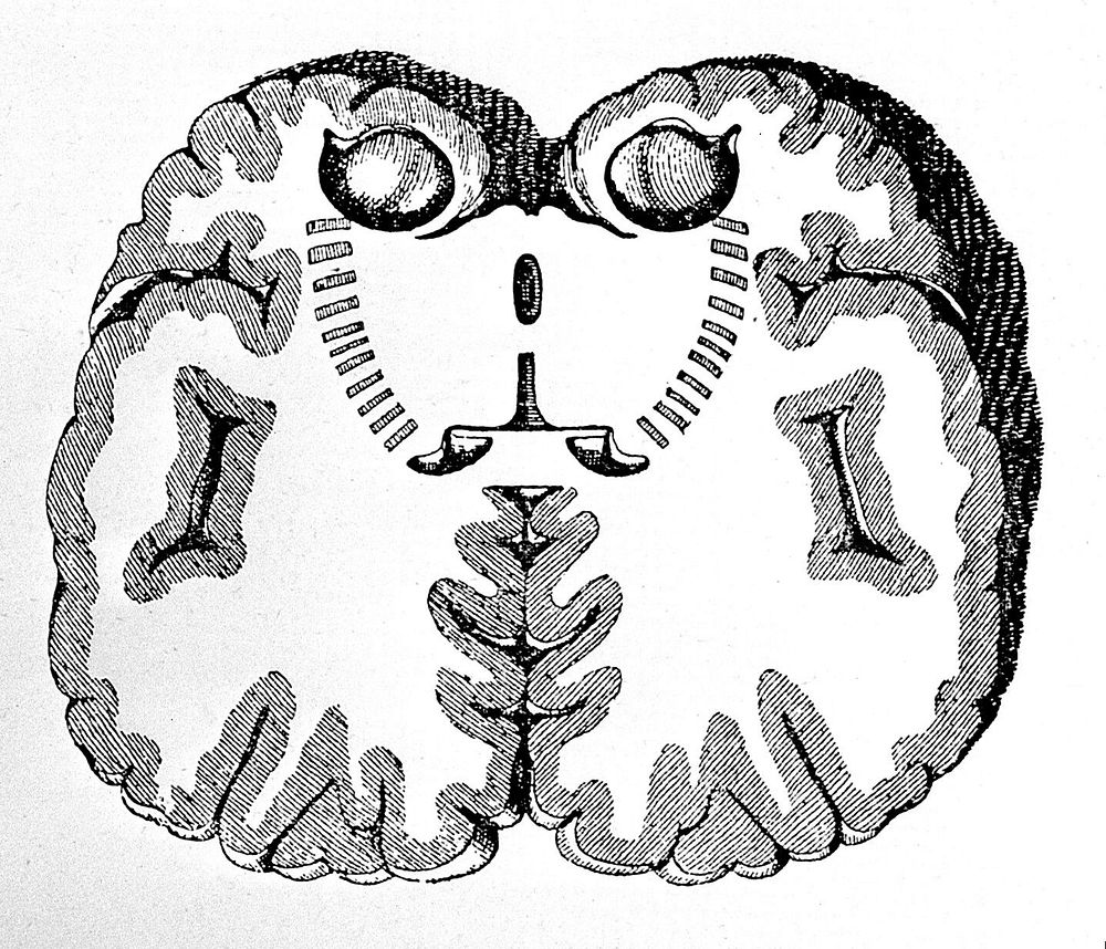 Plate showing coronal section of brain.