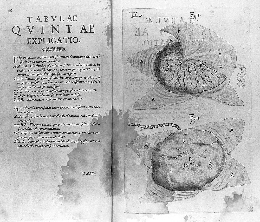 De formato foetu liber singularis aeneis figuris exornatus. Epistolae duae anatomicae. Tractatus de arthritide / Opera…